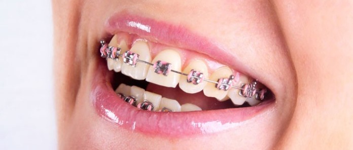 zęby a leczenie ortodoncją