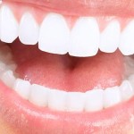 Co warto wiedzieć o implantach zębowych 604905679-150x150