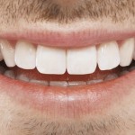 Czy implanty zębowe są bezpieczne? Jakie utrudnienia czekają na właściciela? 664896900-150x150