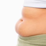 Cellulit a odsysanie tłuszczu – czy rzeczywiście skuteczne? shutterstock_38467303-150x150