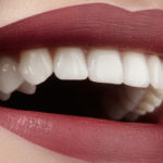 Aż 98 proc. Polaków ma problemy z zębami Fotolia_100467759_S-150x150
