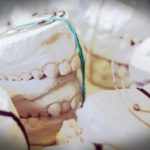 Korony zębowe - model giposwy