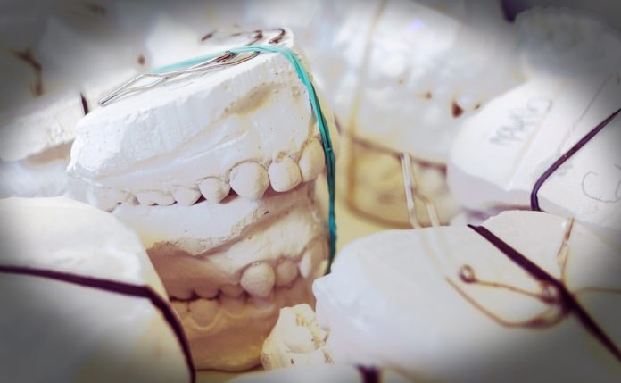 Korony zębowe - model giposwy