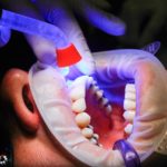 5 faktów o codziennej higienie jamy ustnej wybielanie-zebow-beyond-150x150