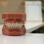 Zdrowie zaczyna się u dentysty szczeka-zeby-150x150