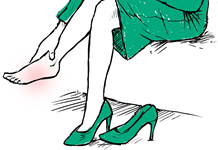 sposoby na płaskostopie jak je leczyć